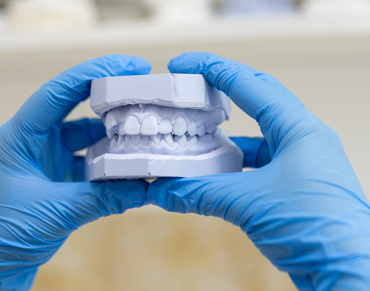Michael-Riordan-DMD-blue-gloves-holding-plaster-cast-of-teeth