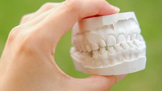 Michael-Riordan-Orthodontics-3D-model-of-teeth