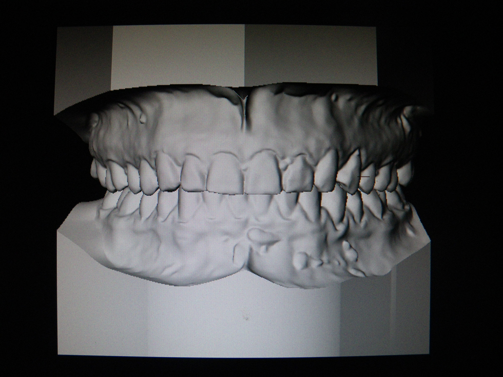 Michael-Riordan-Orthodontics-3d-model-1