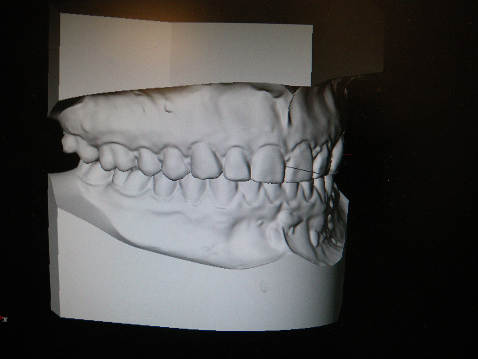 Michael-Riordan-Orthodontics-3d-model-3