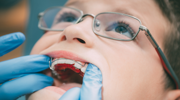 Michael-Riordan-Orthodontics-early-orthodontic-treatment