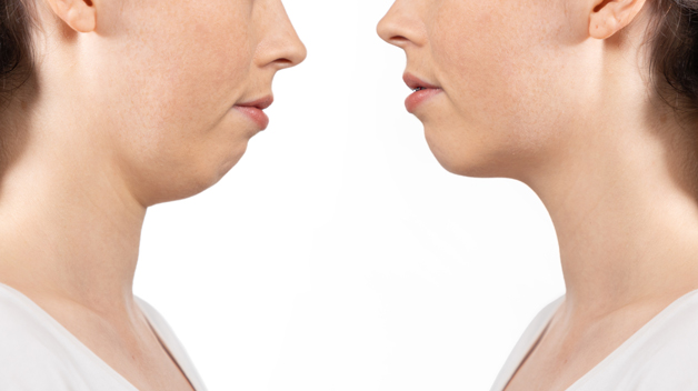 Michael-Riordan-Orthodontics-jaw-surgery